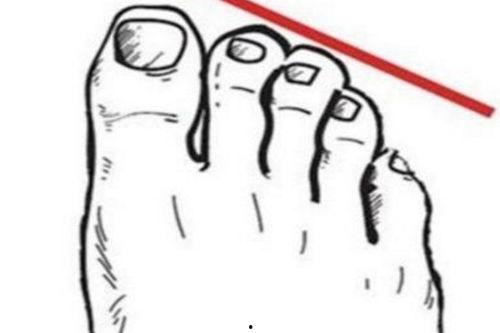 脚型图片,从图片看懂你的独特步态