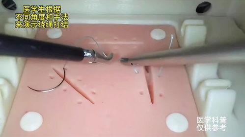 手术缝合钉拆除视频,专业操作与术后护理指南