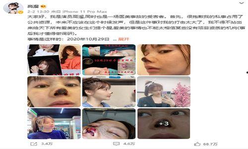 《针》 在线观看,揭秘针疗的神奇疗效与独特魅力