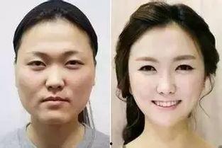 中国的美图韩国的整容,中国美图与韩国整容的视觉对话