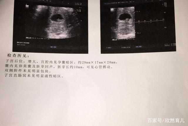 35天孕囊大小图片